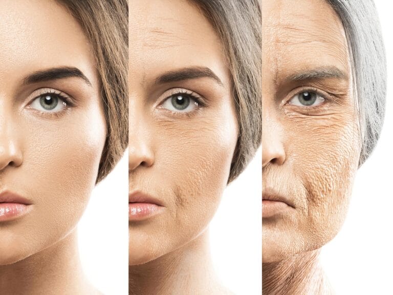 Rewriting Aging